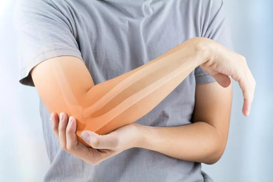 Osteoporosis-Doctor A close-up of a woman holding her elbow with an illustration of the bones and joint experiencing pain from osteoporosis. Get osteoporosis treatment from Vitality Medical in Seattle.