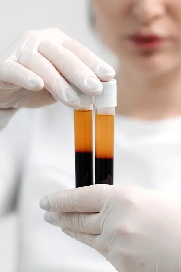 Close-up of a nurse's gloved hands holding two vials of plasma, representing PRP facelift and facial treatments from Vitality Medical in Seattle.
