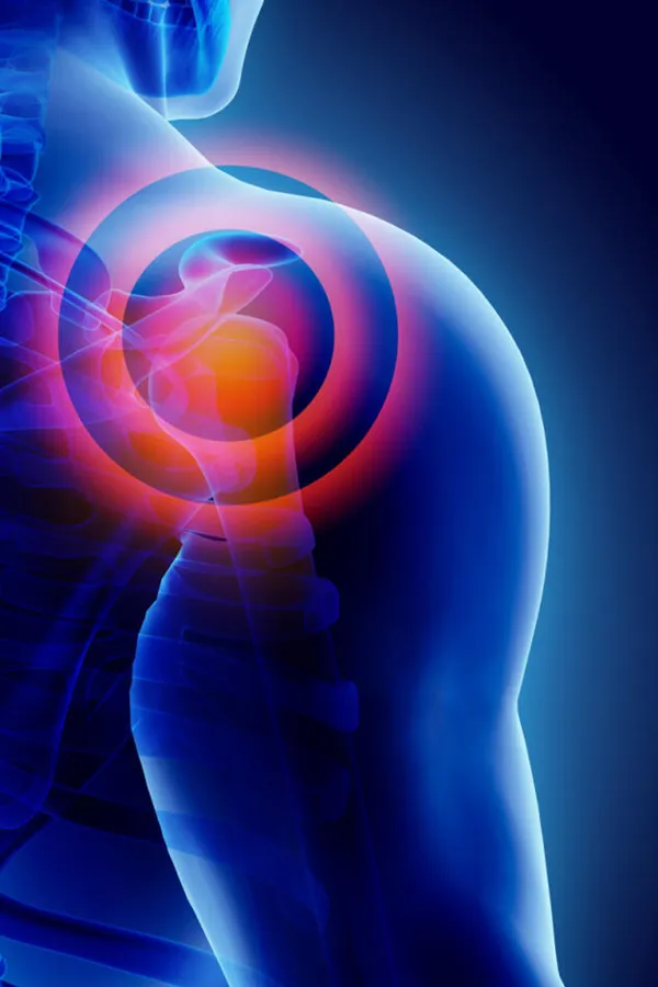 PRP-for-Shoulder-Injury-Treatment A 3D image of a transparent human shoulder, with red radiating circles representing shoulder pain, which can be relieved by PRP treatment for shoulder pain from Vitality Medical in Seattle.