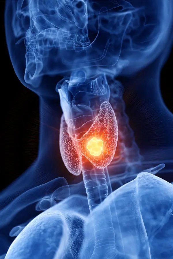 Thyroid-Imbalance-Treatment A 3D illustration of an x-ray of a human neck, highlighting the thyroid. Get help with thyroid imbalance from Vitality Medical in Seattle.